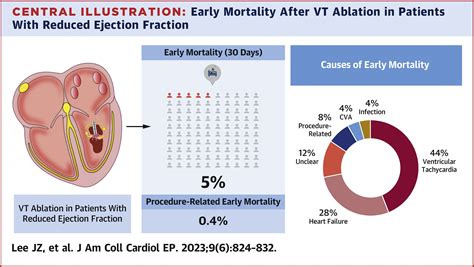 45 ejection fraction prognosis.